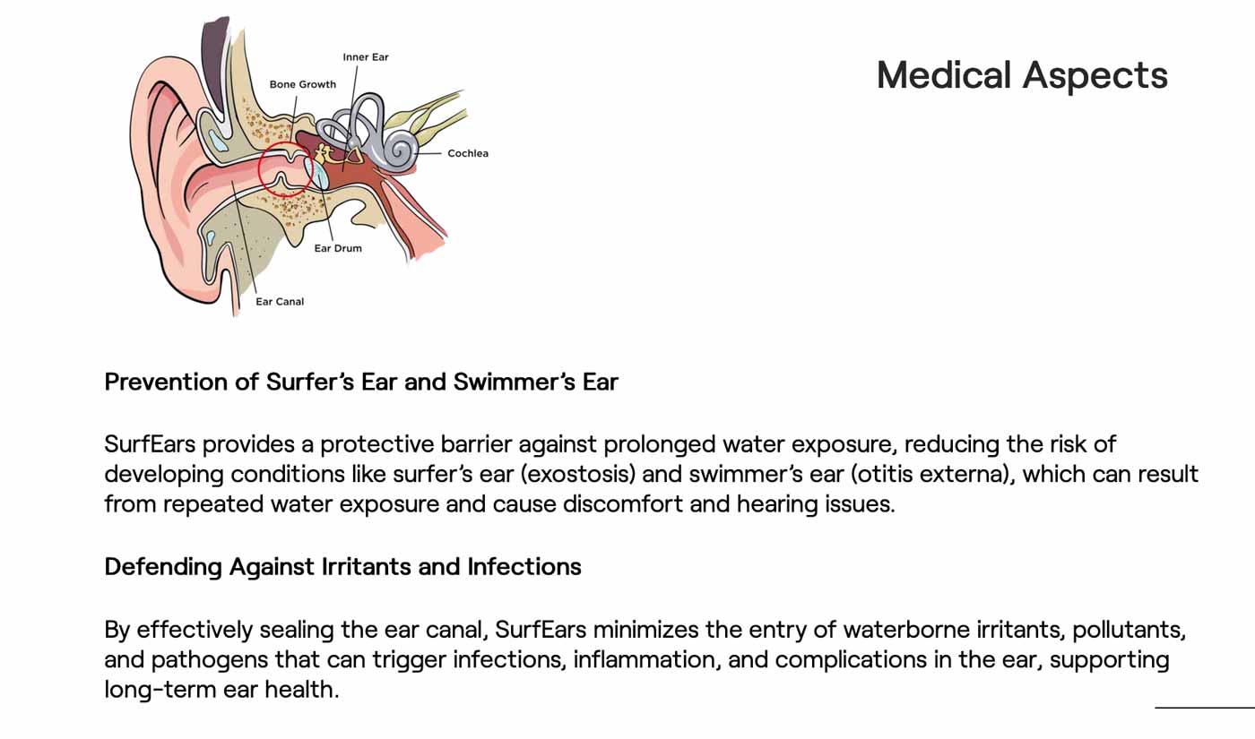 SurfEars 4.0 Earplugs – Coral Sky